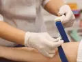 Pielęgniarka zakłada opaskę uciskową na ramię pacjenta, przygotowując do pobrania krwi. Badanie pomoże ocenić, jak obniżyć mocznik we krwi.