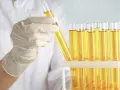 Ręka w rękawiczce laboratoryjnej trzyma probówkę z żółtym płynem. Obok stoi stojak z wieloma probówkami, zawierającymi ten sam płyn, być może roztwór cukru gronowego.