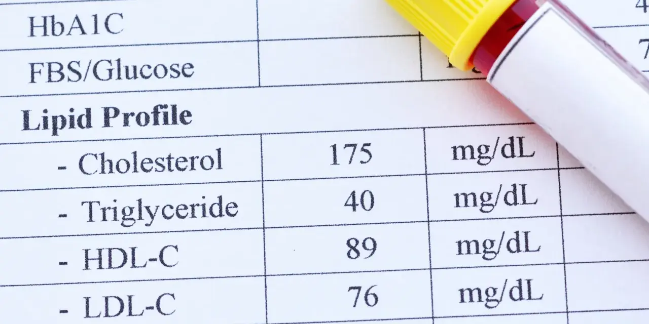 Wynik lipidogramu: cholesterol HDL w surowicy wynosi 89 mg/dL. Obok leży probówka z krwią.