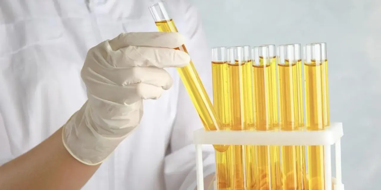 Ręka w rękawiczce laboratoryjnej trzyma probówkę z żółtym płynem. Obok stoi stojak z wieloma probówkami, zawierającymi ten sam płyn, być może roztwór cukru gronowego.