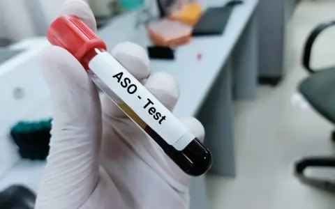 Rękawiczka trzyma probówkę z krwią do testu ASO. Podwyższone ASO może wskazywać na bóle stawów.