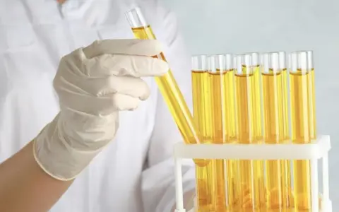 Ręka w rękawiczce laboratoryjnej trzyma probówkę z żółtym płynem. Obok stoi stojak z wieloma probówkami, zawierającymi ten sam płyn, być może roztwór cukru gronowego.