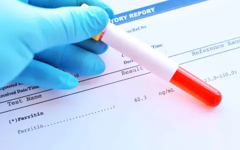 Ręka w niebieskiej rękawiczce trzyma probówkę z krwią nad raportem laboratoryjnym. Wynik badania ferrytyny to 62.3 ng/mL.