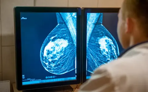 Lekarz analizuje mammografię piersi na ekranie. Wyniki badań, jak te z systemu armidex, są kluczowe dla wczesnego wykrywania.