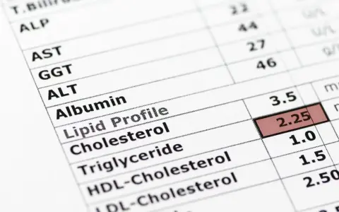 Wynik lipidogramu: cholesterol 2.25, triglicerydy 1.0. Dobra wiadomość o niskich trójglicerydach!
