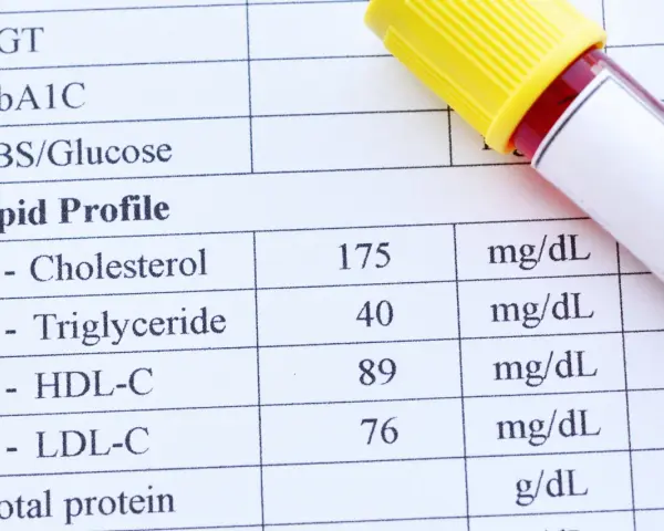 Wynik lipidogramu: cholesterol HDL w surowicy wynosi 89 mg/dL. Obok leży probówka z krwią.