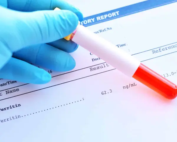 Ręka w niebieskiej rękawiczce trzyma probówkę z krwią nad raportem laboratoryjnym. Wynik badania ferrytyny to 62.3 ng/mL.