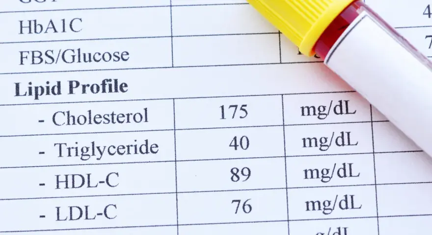 Wynik lipidogramu: cholesterol HDL w surowicy wynosi 89 mg/dL. Obok leży probówka z krwią.