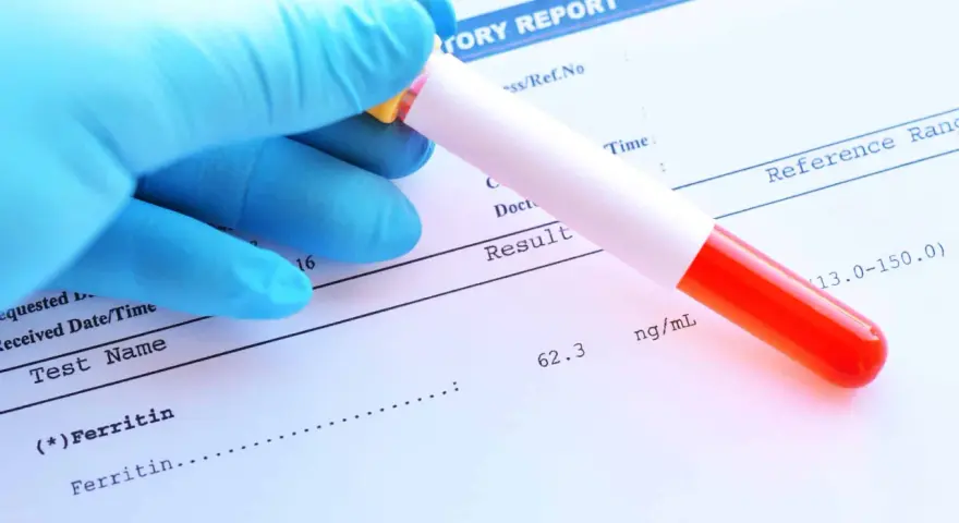 Ręka w niebieskiej rękawiczce trzyma probówkę z krwią nad raportem laboratoryjnym. Wynik badania ferrytyny to 62.3 ng/mL.