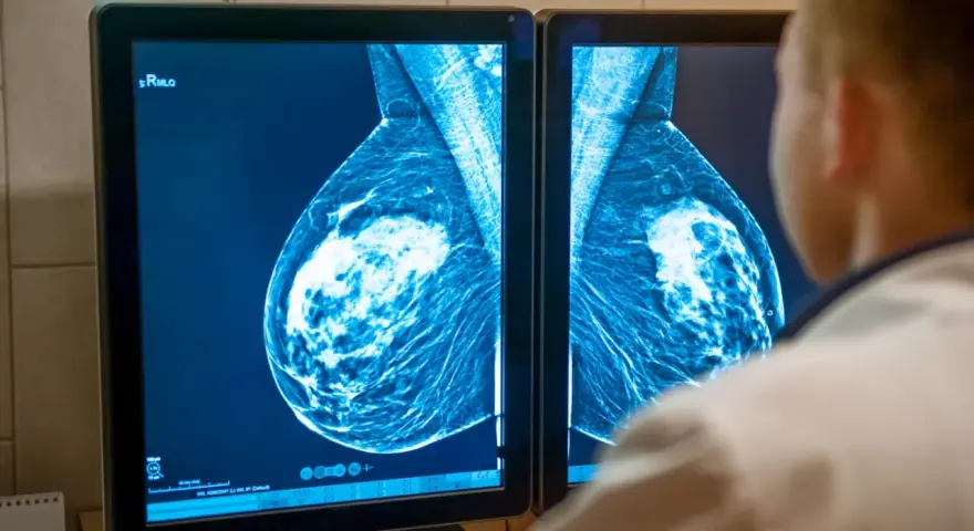 Lekarz analizuje mammografię piersi na ekranie. Wyniki badań, jak te z systemu armidex, są kluczowe dla wczesnego wykrywania.