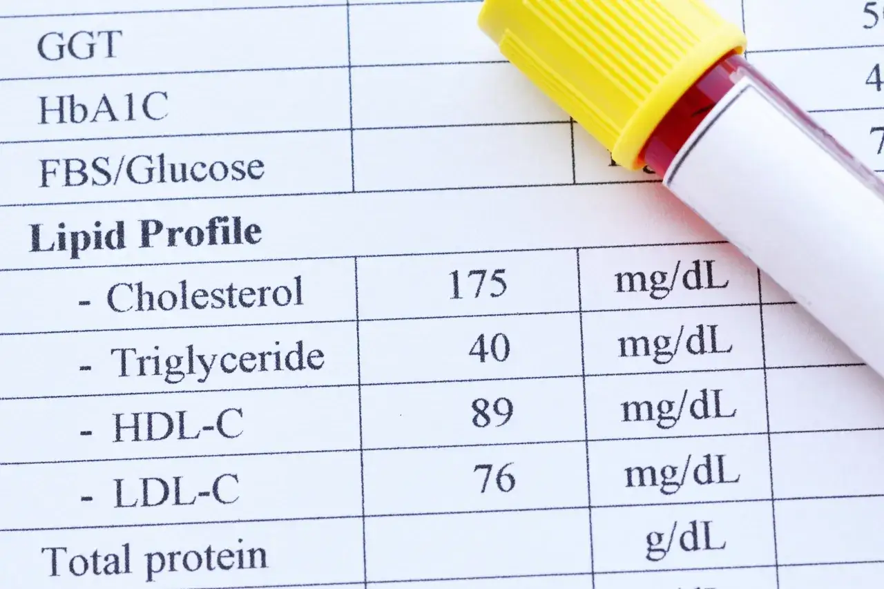 Wynik badania lipidogramu: cholesterol HDL w surowicy wynosi 89 mg/dL. Obok leży probówka z krwią.